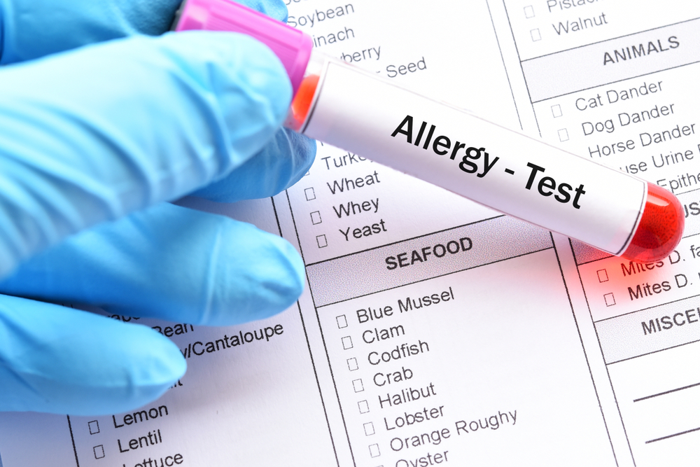 Allergy Testing