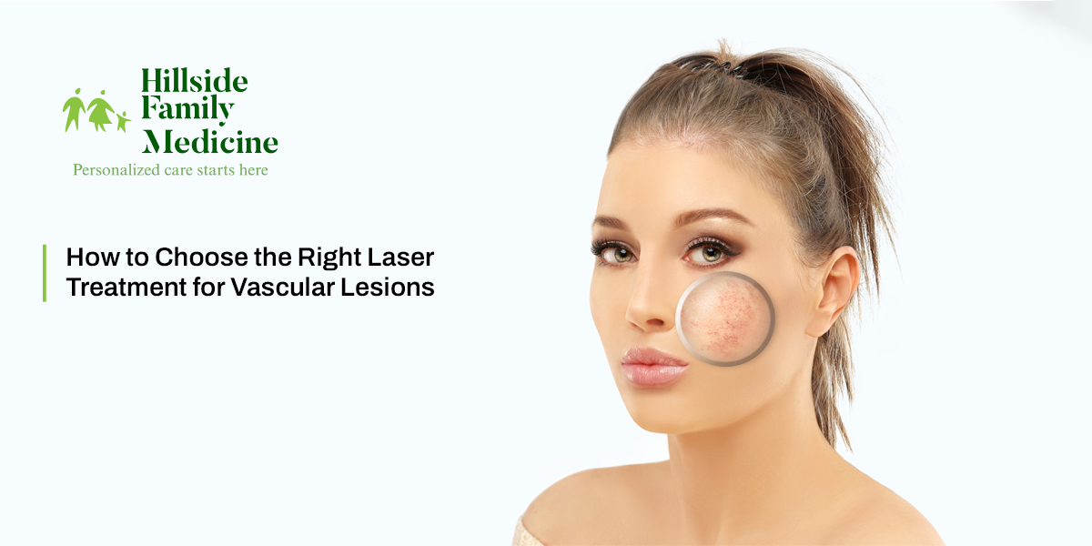 How to Choose the Right Laser Treatment for Vascular Lesions