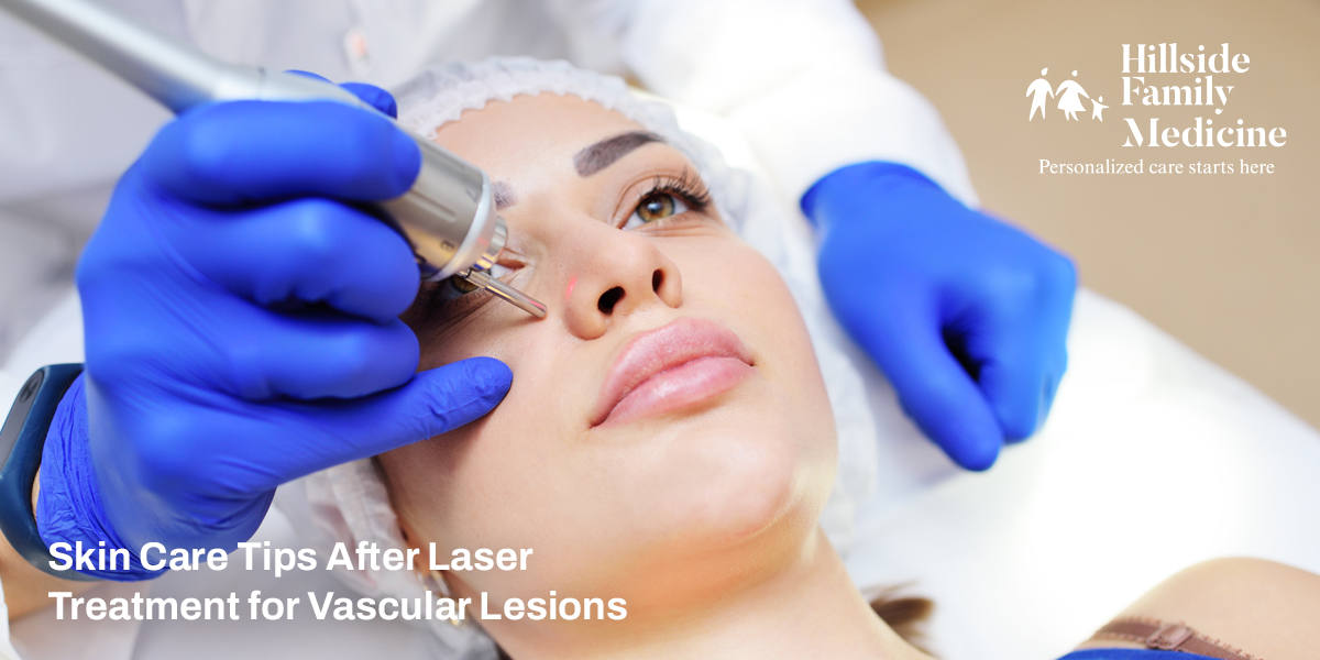 Skin Care Tips After Laser Treatment for Vascular Lesions