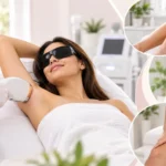 Laser Hair Removal in Acworth, GA