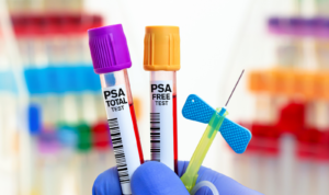 PSA Testing and Prostate Screening